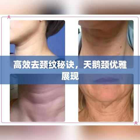高效去颈纹秘诀，天鹅颈优雅展现
